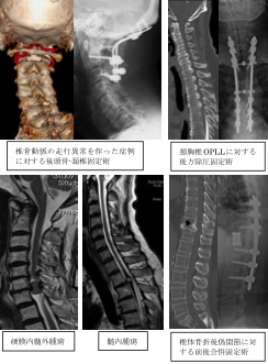 脊椎・脊髄外科 | 診療グループ | 筑波大学 整形外科